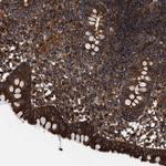 EPS15R Polyclonal Antibody