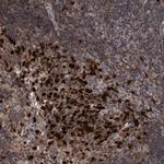 SLBP Polyclonal Antibody
