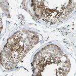 TXNDC3 Polyclonal Antibody