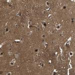 SRRM3 Antibody in Immunohistochemistry (Paraffin) (IHC (P))