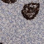 WDR31 Polyclonal Antibody