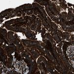 SNX30 Antibody in Immunohistochemistry (Paraffin) (IHC (P))