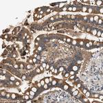 WDR31 Antibody in Immunohistochemistry (Paraffin) (IHC (P))