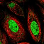 LRRC61 Polyclonal Antibody