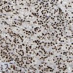 LRRC61 Antibody in Immunohistochemistry (Paraffin) (IHC (P))