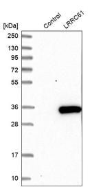 LRRC61 Antibody in Western Blot (WB)