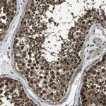 ANKIB1 Antibody in Immunohistochemistry (Paraffin) (IHC (P))