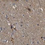 PPWD1 Antibody in Immunohistochemistry (IHC)