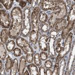 ARL6 Polyclonal Antibody