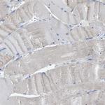 CROT Antibody in Immunohistochemistry (IHC)