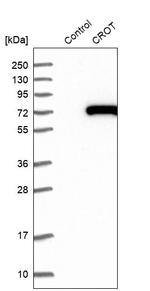 CROT Antibody in Western Blot (WB)