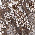 CROT Antibody in Immunohistochemistry (Paraffin) (IHC (P))