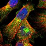 LRBA Polyclonal Antibody