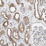 LRBA Antibody in Immunohistochemistry (IHC)