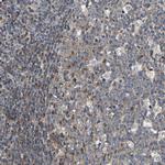 LRBA Antibody in Immunohistochemistry (IHC)