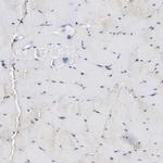 LRBA Antibody in Immunohistochemistry (IHC)