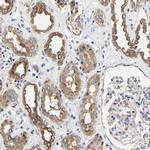 LRBA Antibody in Immunohistochemistry (IHC)
