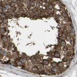 GCC1 Antibody in Immunohistochemistry (IHC)