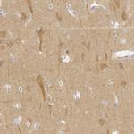 KCNH1 Polyclonal Antibody