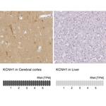 KCNH1 Antibody in Immunohistochemistry (IHC)