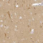 KCNH1 Antibody in Immunohistochemistry (IHC)