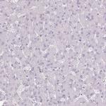 KCNH1 Antibody in Immunohistochemistry (IHC)