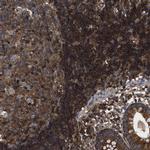 SAMD9L Antibody in Immunohistochemistry (IHC)