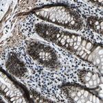 PRCC Polyclonal Antibody