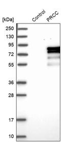 PRCC Antibody in Western Blot (WB)