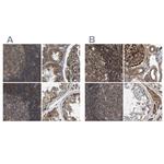 SAMD9L Polyclonal Antibody