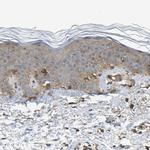 SAMD9L Antibody in Immunohistochemistry (IHC)