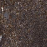 SAMD9L Antibody in Immunohistochemistry (IHC)