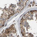 SAMD9L Antibody in Immunohistochemistry (IHC)