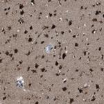 ZFAND2A Antibody in Immunohistochemistry (Paraffin) (IHC (P))