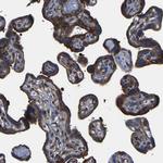 TRK fused gene Antibody in Immunohistochemistry (Paraffin) (IHC (P))