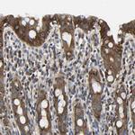 TRK fused gene Antibody in Immunohistochemistry (Paraffin) (IHC (P))