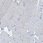 TRK fused gene Antibody in Immunohistochemistry (Paraffin) (IHC (P))