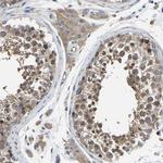 TRK fused gene Antibody in Immunohistochemistry (Paraffin) (IHC (P))