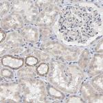 FAM188B Antibody in Immunohistochemistry (IHC)