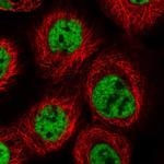 PRCC Polyclonal Antibody