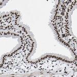 PRCC Antibody in Immunohistochemistry (IHC)
