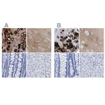 HAPLN1 Antibody in Immunohistochemistry (IHC)
