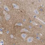 HAPLN1 Antibody in Immunohistochemistry (IHC)