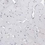 BAIAP2L1 Antibody in Immunohistochemistry (Paraffin) (IHC (P))