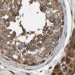 SAMD9L Antibody in Immunohistochemistry (IHC)