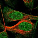 IQCE Polyclonal Antibody