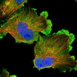 ERC1 Antibody in Immunocytochemistry (ICC/IF)
