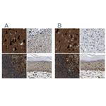 NUDCD3 Polyclonal Antibody