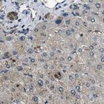 NUDCD3 Antibody in Immunohistochemistry (IHC)