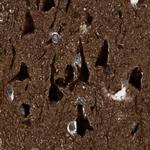 NUDCD3 Antibody in Immunohistochemistry (IHC)